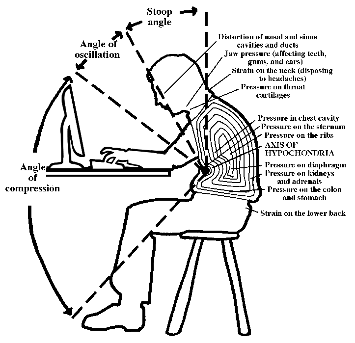 Poor posture leads to multiple health problems